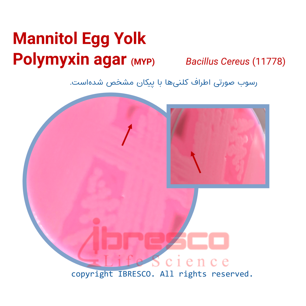 MYP Agar | Ibresco