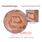 Columbia_Blood_Agar_Streptococcus_pyogenes(19615)