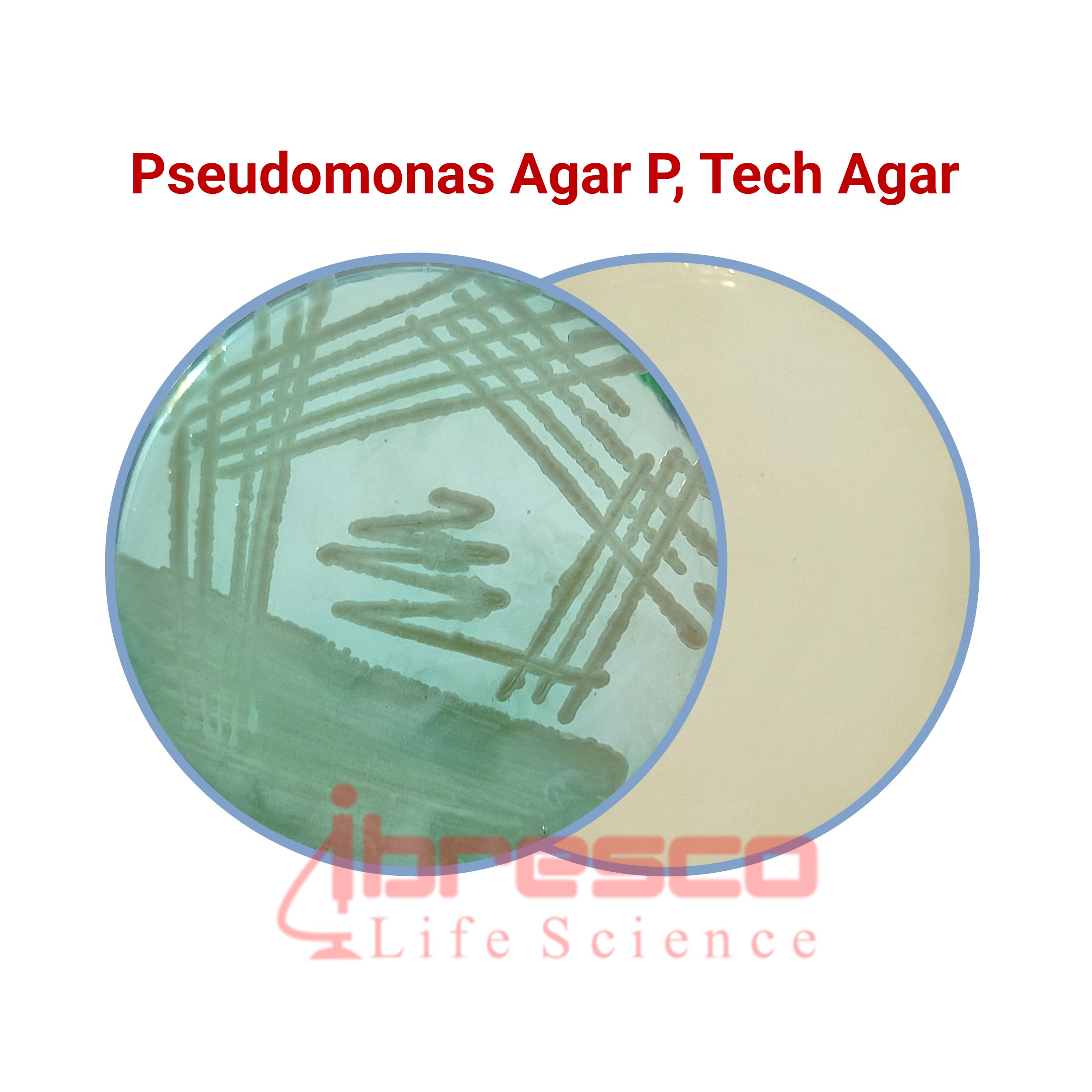 ビカクシダ　P. Bacteria Transmission electron micrographs of ultrathin sections of